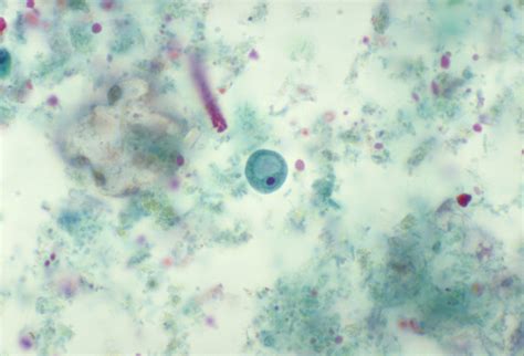  Iodamoeba:  An Amoeboid Enigma Hiding in Your Water Supply!