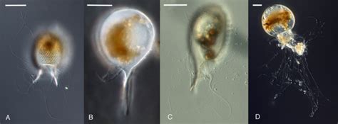  Urospirocystis! An Unseen Champion with Exquisite Filamentous Pseudopods