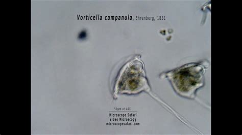  Vorticella! A Tiny Whirlwind with Hairy Arms That Dance Through the Water